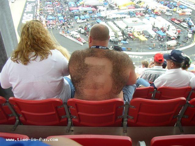 hairy-back-omg-96.jpg